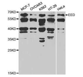 Western blot - EED Antibody from Signalway Antibody (32811) - Antibodies.com