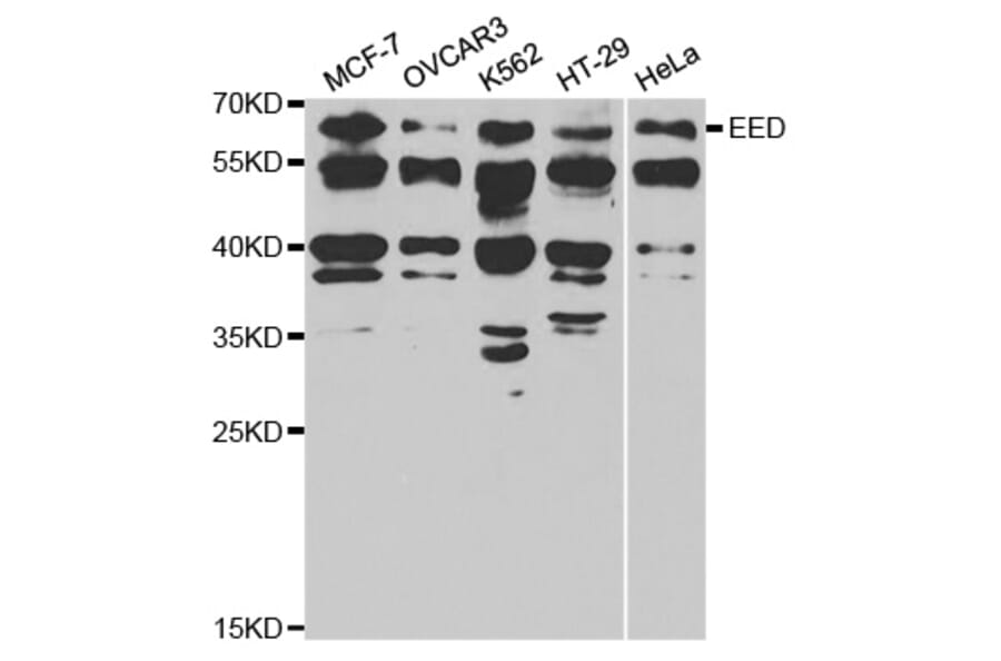 Western blot - EED Antibody from Signalway Antibody (32811) - Antibodies.com