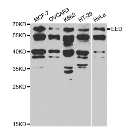 Western blot - EED Antibody from Signalway Antibody (32811) - Antibodies.com