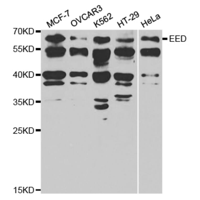 Western blot - EED Antibody from Signalway Antibody (32811) - Antibodies.com
