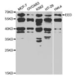Western blot - EED Antibody from Signalway Antibody (32811) - Antibodies.com