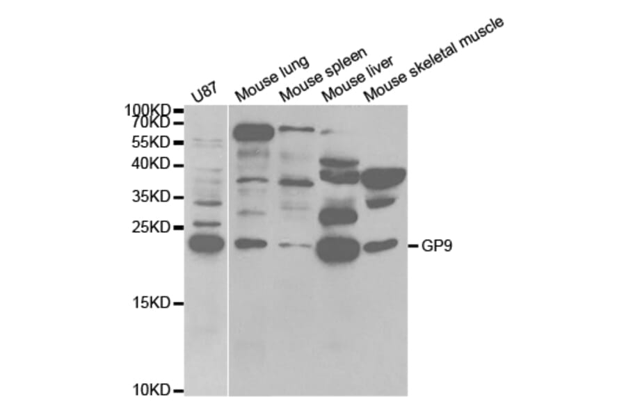 Western blot - GP9 Antibody from Signalway Antibody (32813) - Antibodies.com