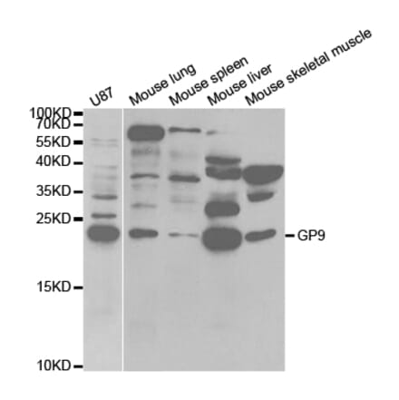 Western blot - GP9 Antibody from Signalway Antibody (32813) - Antibodies.com