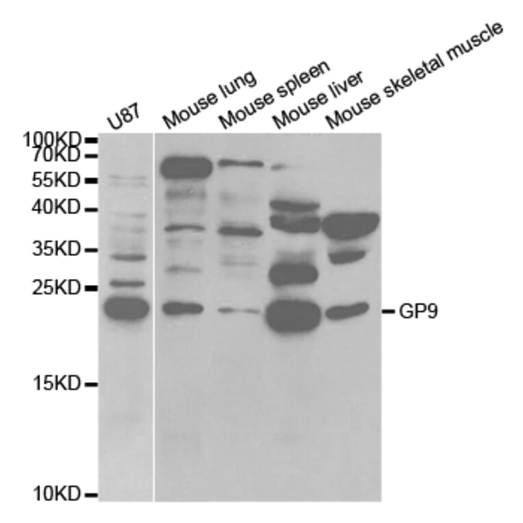 Western blot - GP9 Antibody from Signalway Antibody (32813) - Antibodies.com
