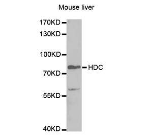 Western blot - HDC Antibody from Signalway Antibody (32865) - Antibodies.com