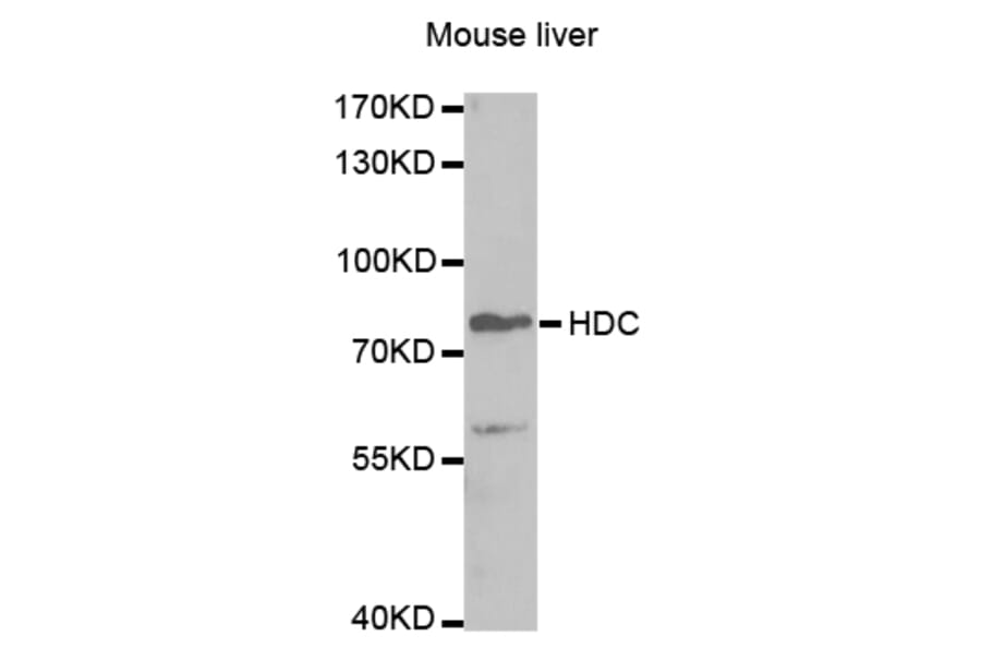 Western blot - HDC Antibody from Signalway Antibody (32865) - Antibodies.com