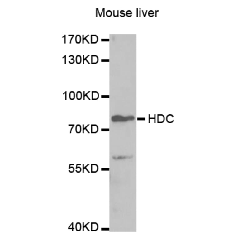 Western blot - HDC Antibody from Signalway Antibody (32865) - Antibodies.com
