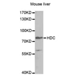 Western blot - HDC Antibody from Signalway Antibody (32865) - Antibodies.com