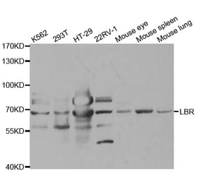 Western blot - LBR Antibody from Signalway Antibody (32868) - Antibodies.com