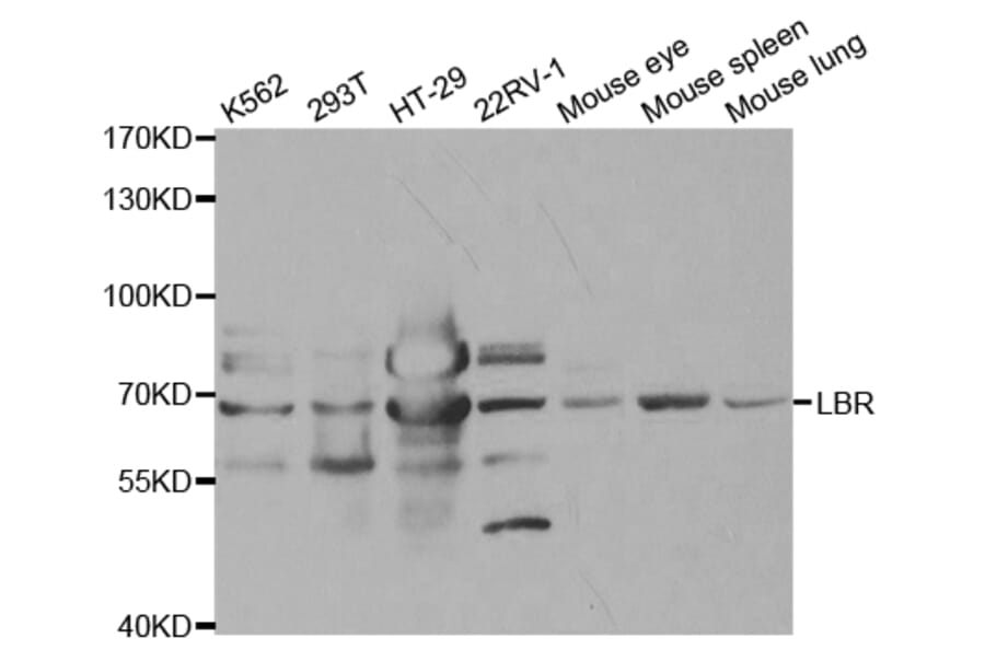 Western blot - LBR Antibody from Signalway Antibody (32868) - Antibodies.com