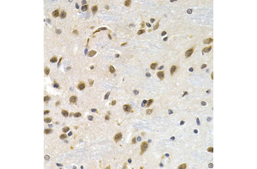 Immunohistochemistry - LBR Antibody from Signalway Antibody (32868) - Antibodies.com