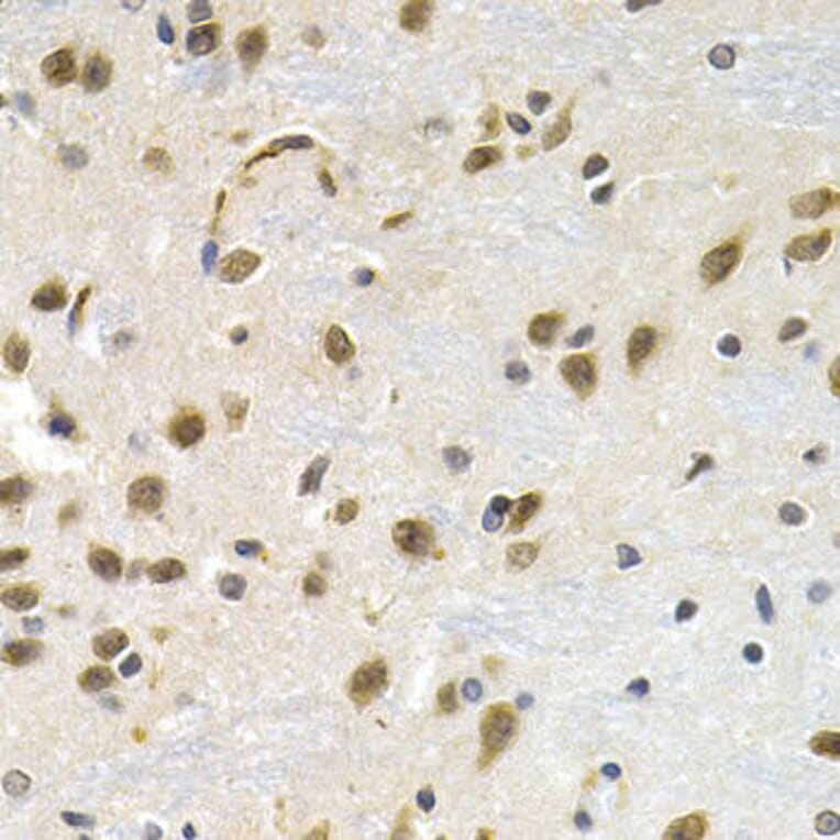 Immunohistochemistry - LBR Antibody from Signalway Antibody (32868) - Antibodies.com