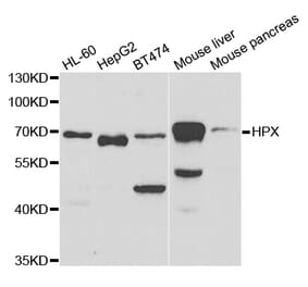 Western blot - HPX Antibody from Signalway Antibody (32919) - Antibodies.com