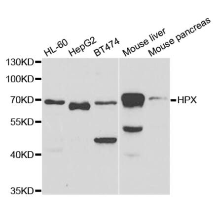 Western blot - HPX Antibody from Signalway Antibody (32919) - Antibodies.com