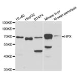 Western blot - HPX Antibody from Signalway Antibody (32919) - Antibodies.com