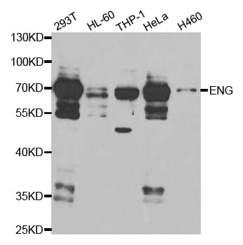 Western blot analysis of extracts of various cell lines, using ENG antibody.