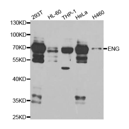 Western blot - ENG Antibody from Signalway Antibody (32940) - Antibodies.com