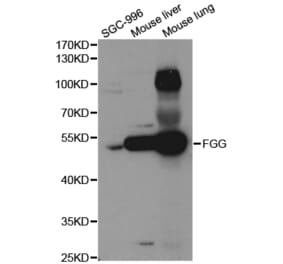 Western blot - FGG Antibody from Signalway Antibody (32941) - Antibodies.com