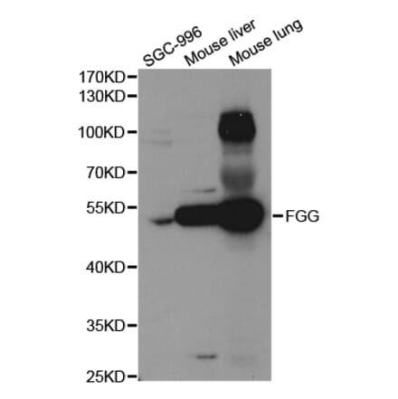 Western blot - FGG Antibody from Signalway Antibody (32941) - Antibodies.com