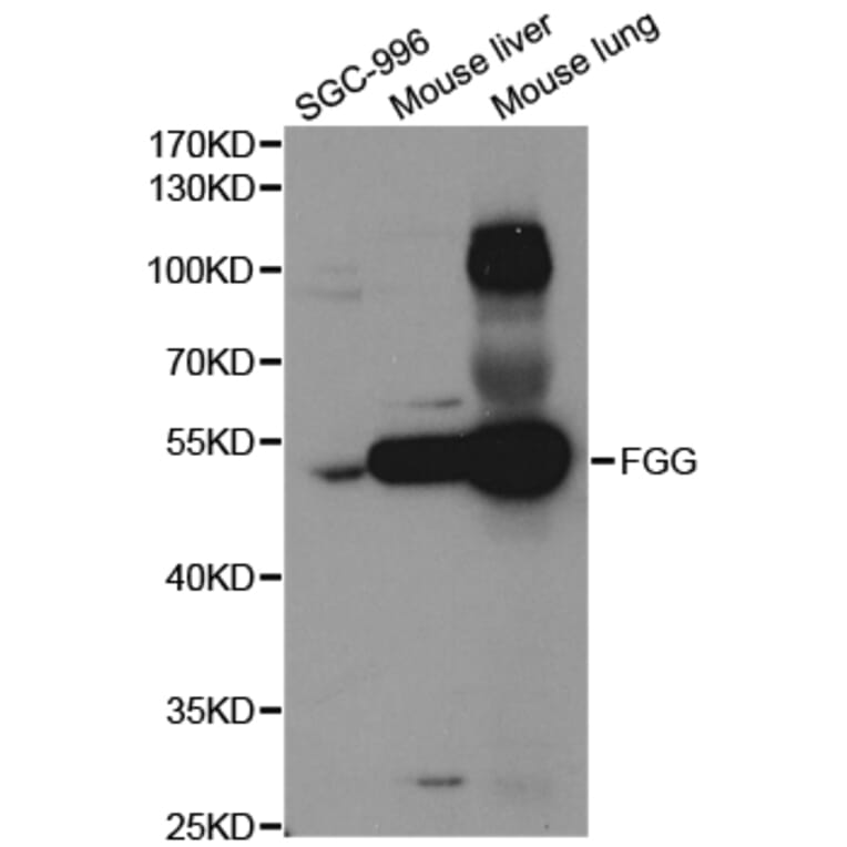 Western blot - FGG Antibody from Signalway Antibody (32941) - Antibodies.com