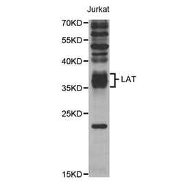 Western blot - LAT Antibody from Signalway Antibody (32948) - Antibodies.com
