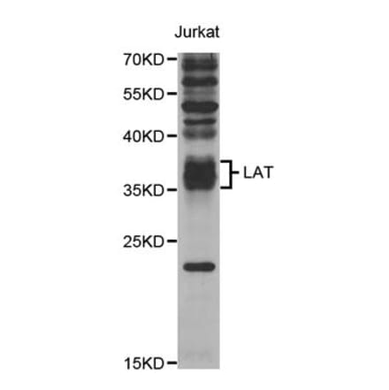 Western blot - LAT Antibody from Signalway Antibody (32948) - Antibodies.com