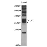 Western blot - LAT Antibody from Signalway Antibody (32948) - Antibodies.com