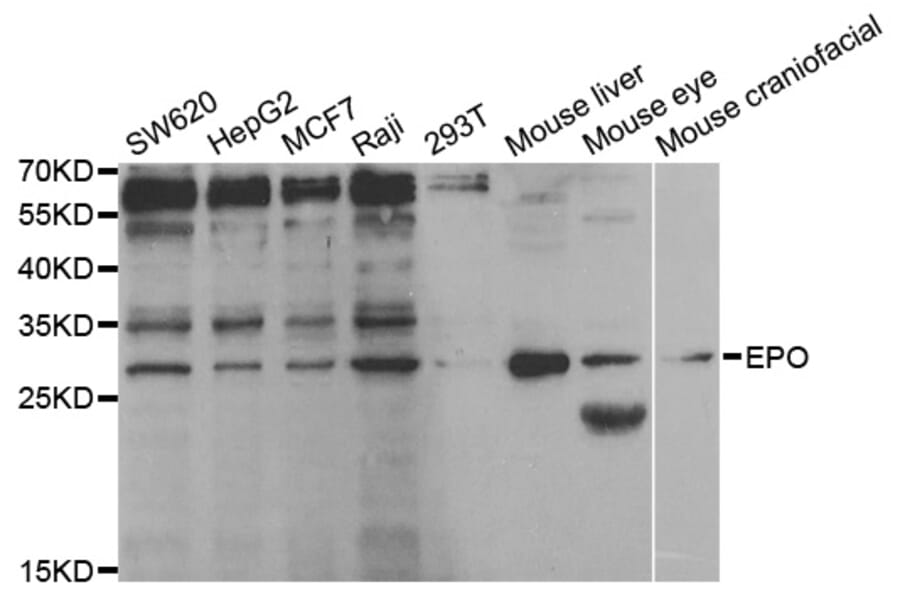 Western blot - EPO Antibody from Signalway Antibody (32958) - Antibodies.com