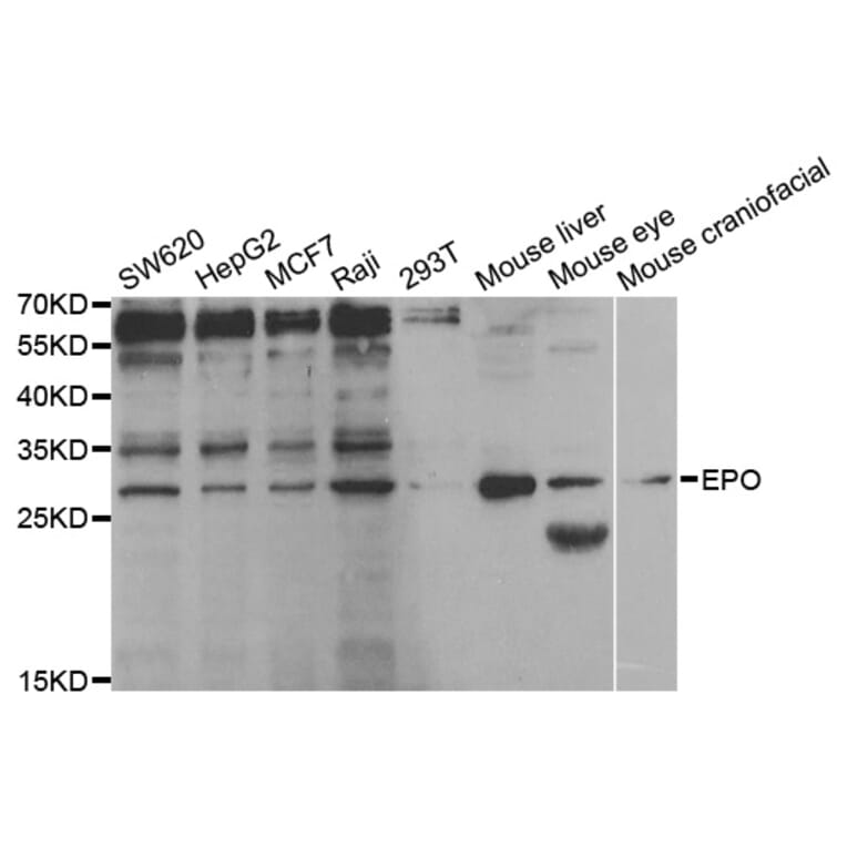 Western blot - EPO Antibody from Signalway Antibody (32958) - Antibodies.com