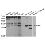 Western blot - EPO Antibody from Signalway Antibody (32958) - Antibodies.com