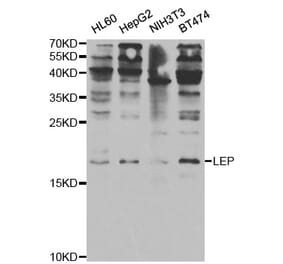 Western blot - LEP Antibody from Signalway Antibody (32965) - Antibodies.com