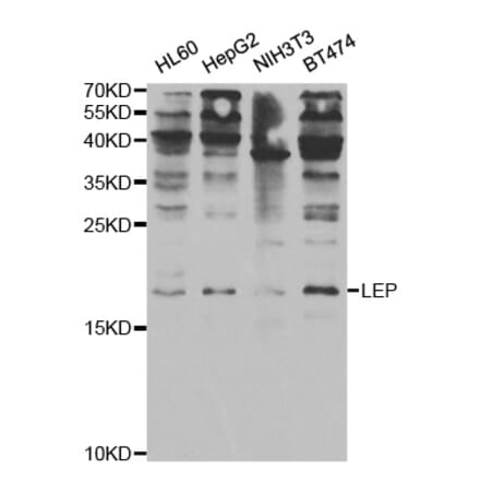 Western blot - LEP Antibody from Signalway Antibody (32965) - Antibodies.com
