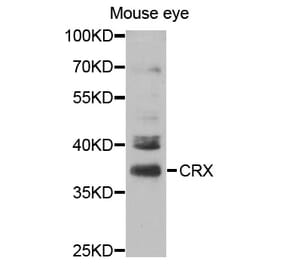 Western blot - CRX Antibody from Signalway Antibody (32991) - Antibodies.com