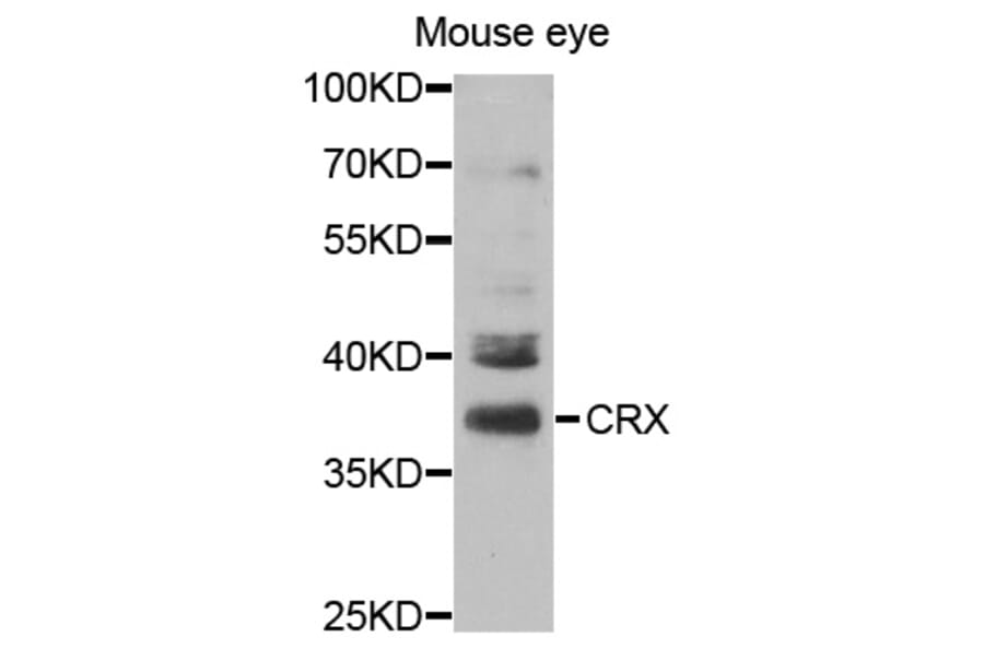 Western blot - CRX Antibody from Signalway Antibody (32991) - Antibodies.com