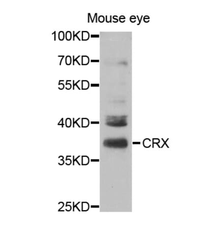 Western blot - CRX Antibody from Signalway Antibody (32991) - Antibodies.com