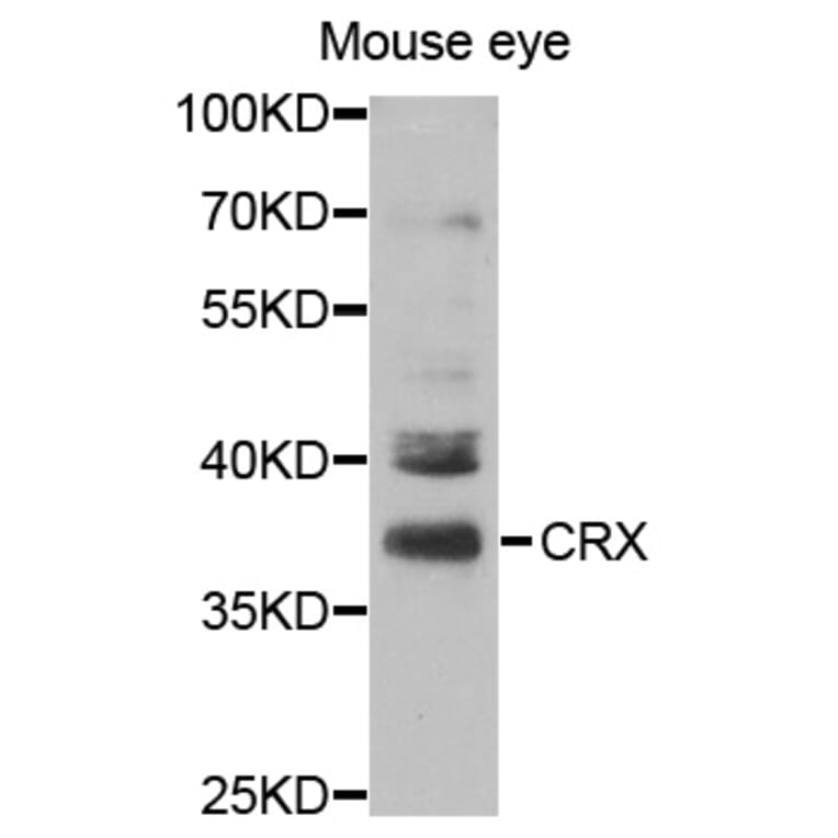 Western blot - CRX Antibody from Signalway Antibody (32991) - Antibodies.com