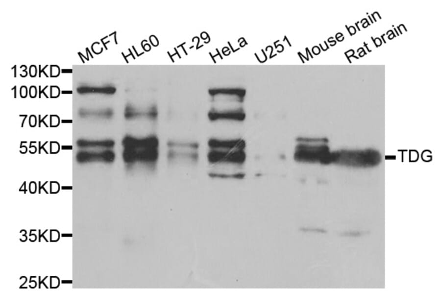 Western blot - TDG Antibody from Signalway Antibody (33020) - Antibodies.com