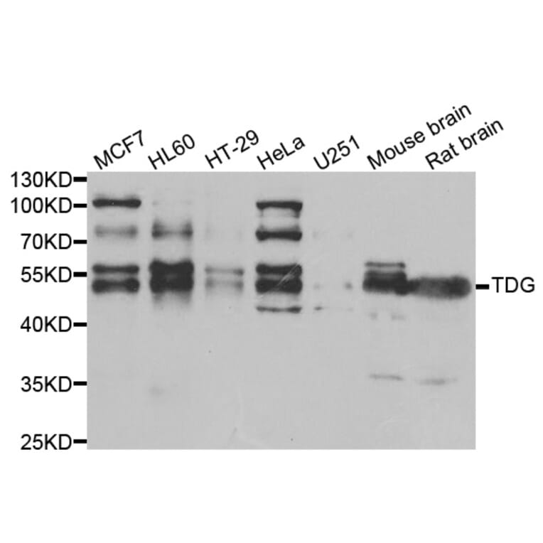 Western blot - TDG Antibody from Signalway Antibody (33020) - Antibodies.com