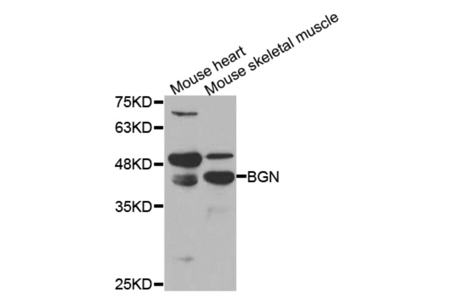 Western blot - BGN Antibody from Signalway Antibody (33032) - Antibodies.com