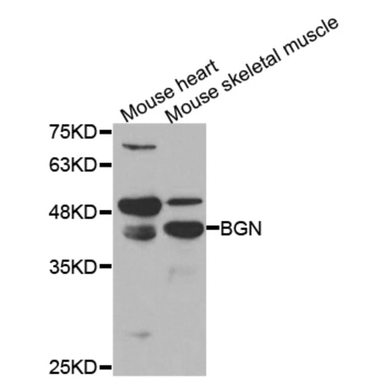 Western blot - BGN Antibody from Signalway Antibody (33032) - Antibodies.com
