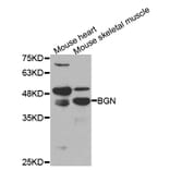 Western blot - BGN Antibody from Signalway Antibody (33032) - Antibodies.com
