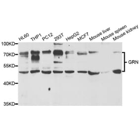 Western blot - GRN Antibody from Signalway Antibody (33035) - Antibodies.com