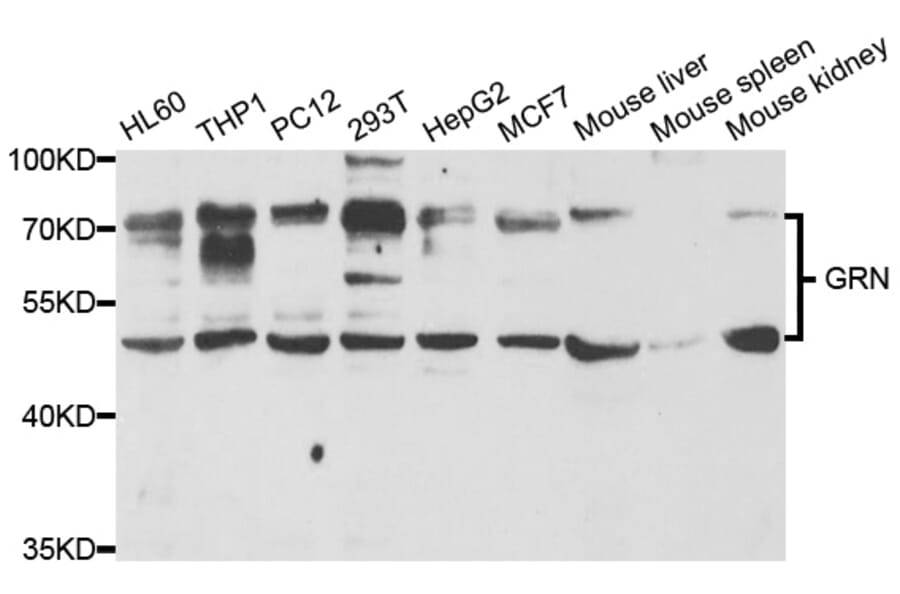 Western blot - GRN Antibody from Signalway Antibody (33035) - Antibodies.com