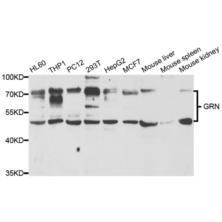 Western blot - GRN Antibody from Signalway Antibody (33035) - Antibodies.com