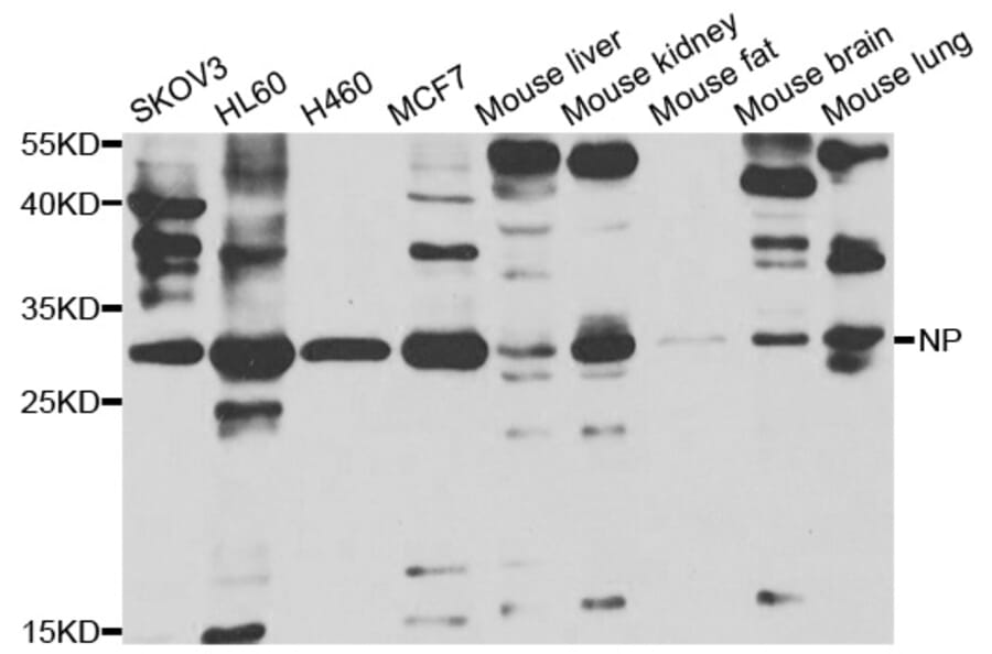 Western blot - PNP Antibody from Signalway Antibody (33040) - Antibodies.com