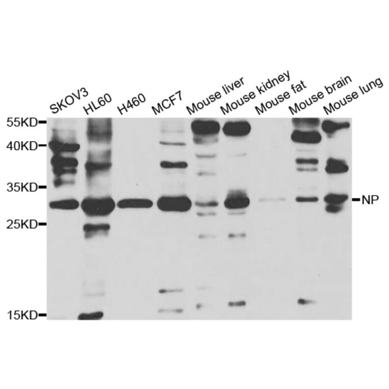 Western blot - PNP Antibody from Signalway Antibody (33040) - Antibodies.com