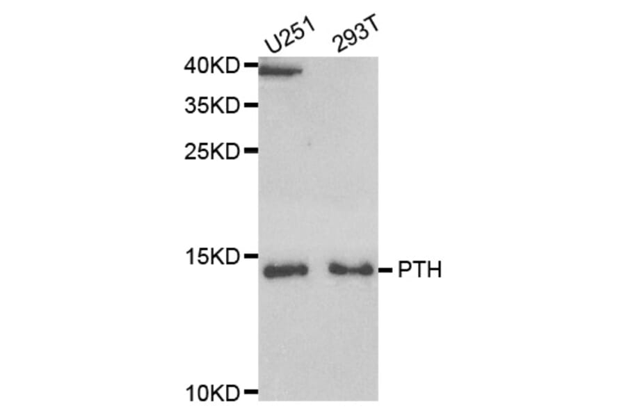 Western blot - PTH Antibody from Signalway Antibody (33084) - Antibodies.com