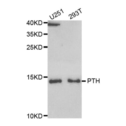 Western blot - PTH Antibody from Signalway Antibody (33084) - Antibodies.com