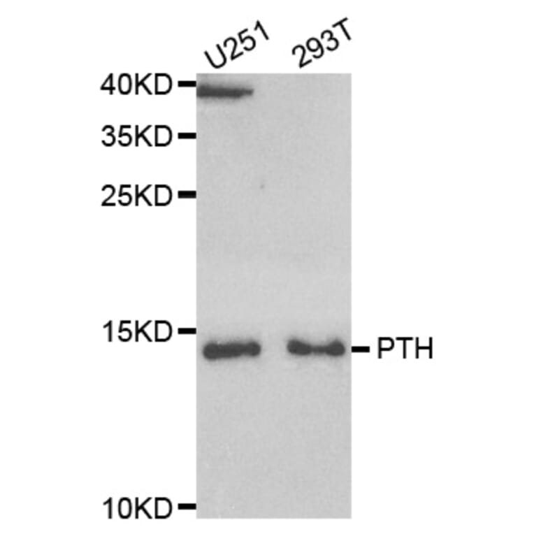 Western blot - PTH Antibody from Signalway Antibody (33084) - Antibodies.com