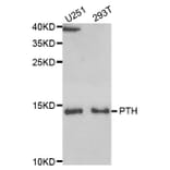 Western blot - PTH Antibody from Signalway Antibody (33084) - Antibodies.com